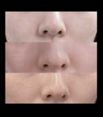 PRETTY FREAK Rejulook - Image 20