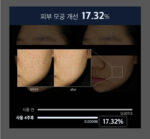 Celladix Sebum Rebalancing RX 131 Ampoule 20ml - Image 4