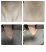 frommedi Nano-step Collagen Neck Mask 13g*4pack - Image 2