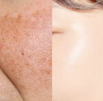 LESSENTIAL Rhodiola Blanc Double Ampoule 50ml - Image 2