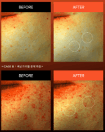 Dr.Melaxin Exosome Repair Mask Pack 30g*5sheet - Image 5