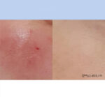 eGFOLOGY EGF Ampoule Set 5ml X 5EA - Image 3