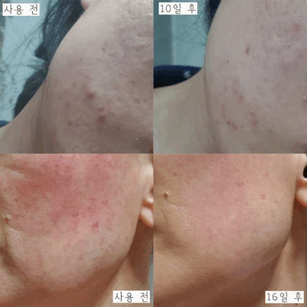 Yashuv Baatlabs Resilience Cream 50ml