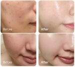 CHARDE Snow Ampoule Niacinamide 3ml*2ea - Image 2