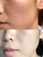 CHAKAN FACTORY Vita Real Pack 100ml - EmpressKorea