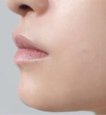 FATION Nosca9 Spot Patch 102ea - EmpressKorea