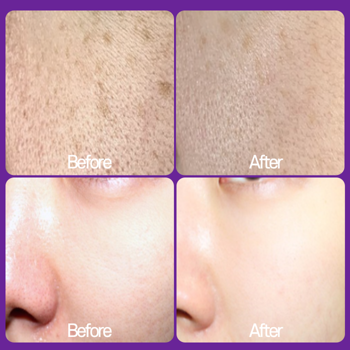 RX Derma Whitening Vita A Cream Retinal 1300ppm Cream Retinol Vitamin A Wrinkle Improvement Whitening Age Spot Removal Night Cream 20ml - EmpressKorea