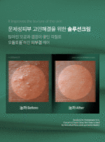 Dr.Beginning Yuljak Cream 30ml - Facial Milla/Flat Warts Improve - Image 2