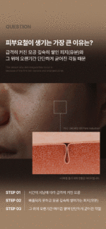 Dr.Beginning Yuljak Cream 30ml - Facial Milla/Flat Warts Improve - Image 9