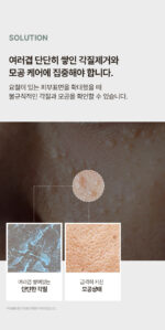 Dr.Beginning Yuljak Cream 30ml - Facial Milla/Flat Warts Improve - Image 10