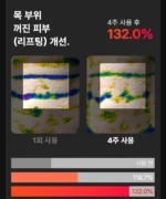 BEAUND NeckCera – The New Standard in Neck Wrinkle Care - Image 20