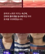 BEAUND NeckCera – The New Standard in Neck Wrinkle Care - Image 31