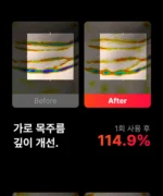 BEAUND NeckCera – The New Standard in Neck Wrinkle Care - Image 49