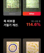 BEAUND NeckCera – The New Standard in Neck Wrinkle Care - Image 51