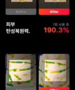 BEAUND NeckCera – The New Standard in Neck Wrinkle Care - Image 52