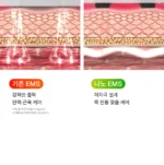 BEAUND NeckCera – The New Standard in Neck Wrinkle Care - Image 70