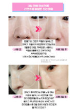 ERKENA PDRN Skin Booster Ampoule 5ml*8bottle - Image 5