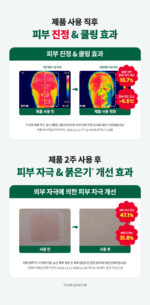 Dr.G R.E.D Blemish Clear Soothing Active Essence 80ml - Image 6