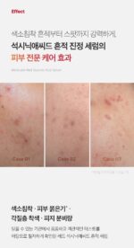 medicube Red Succinic Acid Trace Serum 30ml - Image 7