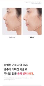 medicube AGE-R Booster Pro - Image 34