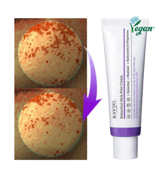 RAVIEL Bakuchiol Mela Free Cream 50ml - Skin abnormalities - SKU: 6565882000362-3a2d2b0f