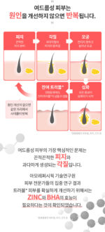 AESTURA Theracne365 Active Serum 30ml - Image 3