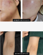 MEDITHERAPY Retinal Skin Booster Serum 150ml - Image 2