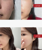 DERMAZIO Brightening Glutoning 26 Powder 14sticks - Image 2