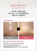 VERAMORE Pore Tightening Spicule 300 Ampoule 50ml - Image 3