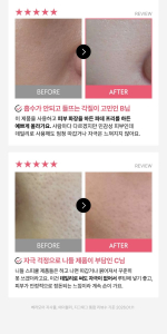 VERAMORE Pore Tightening Spicule 300 Ampoule 50ml - Image 4