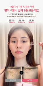 VERAMORE Pore Tightening Spicule 300 Ampoule 50ml - Image 9