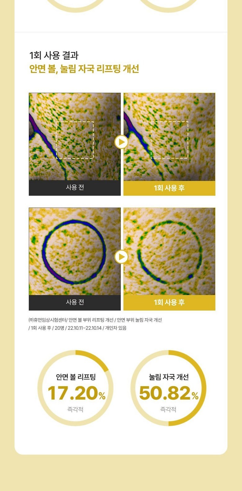 SUNGBOON EDITOR Melting Thread Set Detail